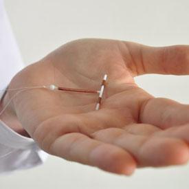 Intrauterine contraceptive device (IUCD) Insertion