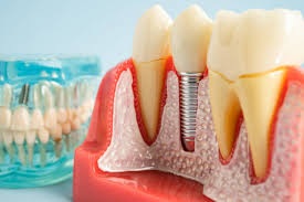 Prosthodontist image