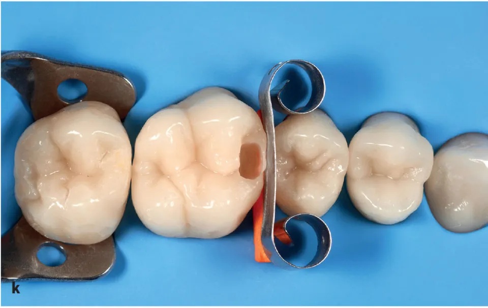 Operative Dentistry image